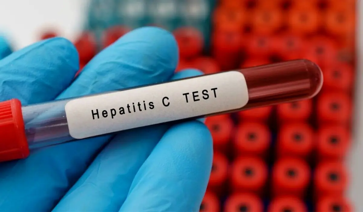 Hepatitis C 